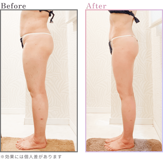 Before After ※効果には個人差があります